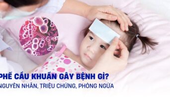 Phế cầu khuẩn gây bệnh gì? Nguyên nhân, triệu chứng, cách phòng ngừa